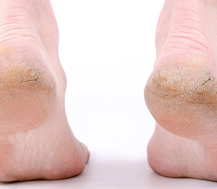 detail of ballet dancer''s feet